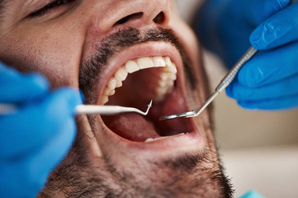 Best Emergency Root Canal Treatment in Milford, UT