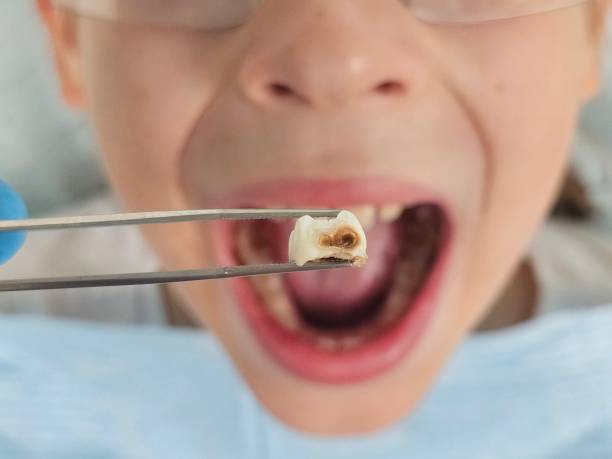 Best Orthodontic Emergency Dentist in Milford, UT